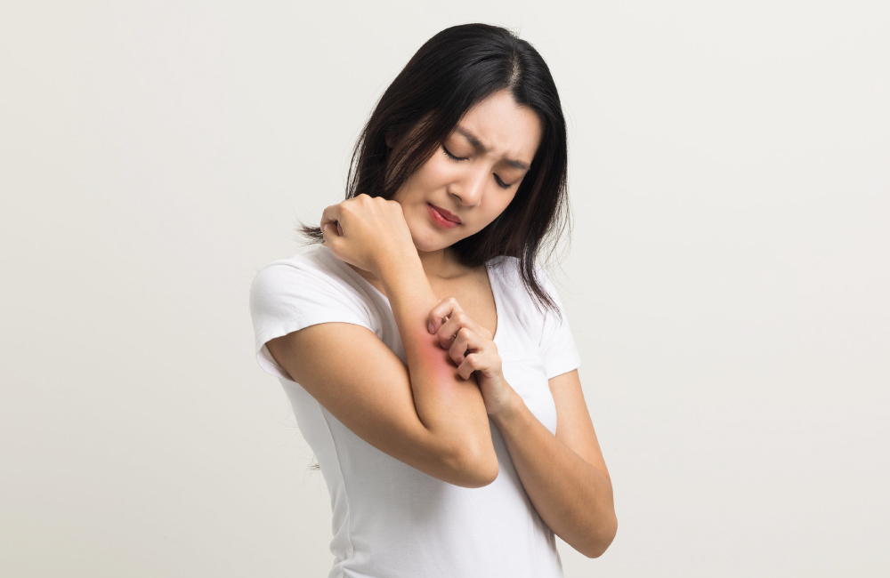 冬季皮膚乾癢症狀